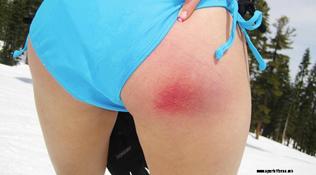 23 Things Snowboarders Hate About Snowboarding