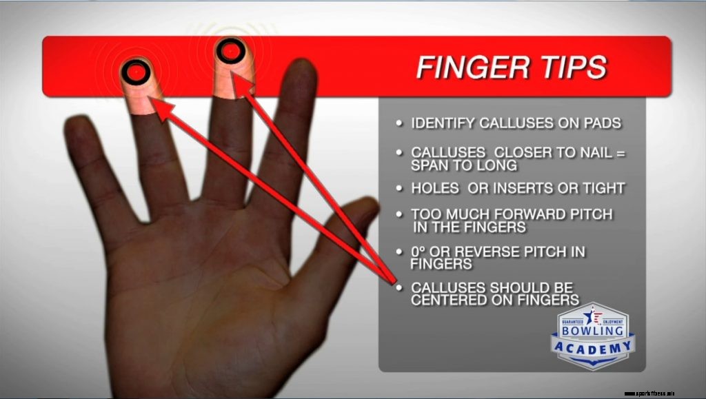 10 fall där fingret gör ont och hur för att fixa det - 1